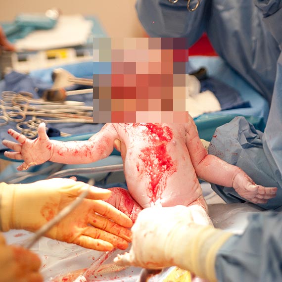 Matka oskar�a lekarzy o �mier� dziecka. Prokuratura wszcz�a ju� �ledztwo