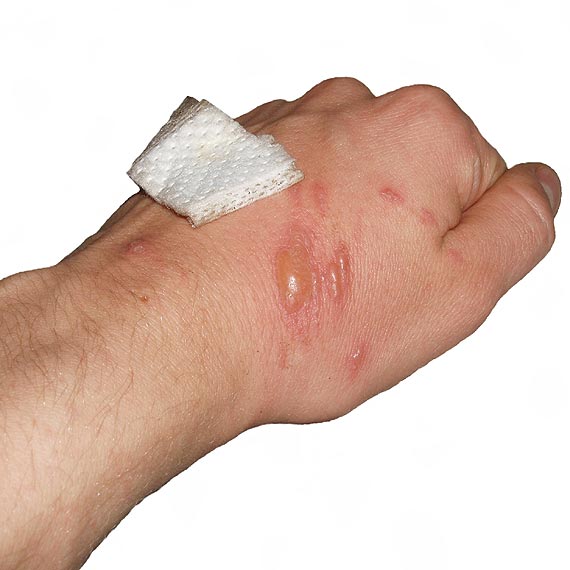 Dofinansowanie na usuwanie gro�nych chwast�w