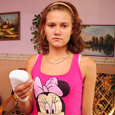 Autobus urwa� nastolatce palec