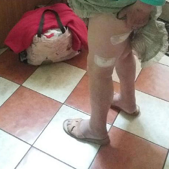 W Dargobdzu psy zaatakoway kobiet. Mieszkacy obawiaj si o swoje ycie