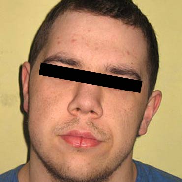 Gryfice: Zatrzymano podejrzewanego o dokonanie morderstwa