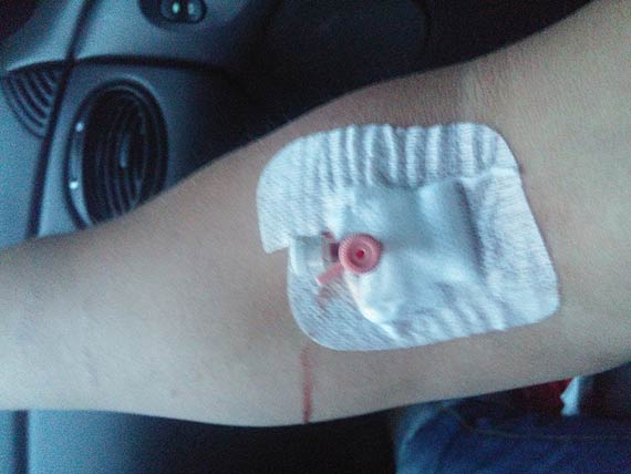 Ze szpitala uciek mczyzna, ktremu zakadano opatrunek