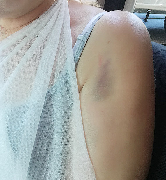 Ambulans potrci kobiet i...odjecha. Poszukuje si wiadkw zdarzenia w Kamieniu Pomorskim