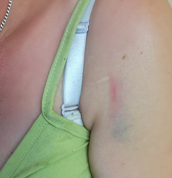 Ambulans potrci kobiet i...odjecha. Poszukuje si wiadkw zdarzenia w Kamieniu Pomorskim