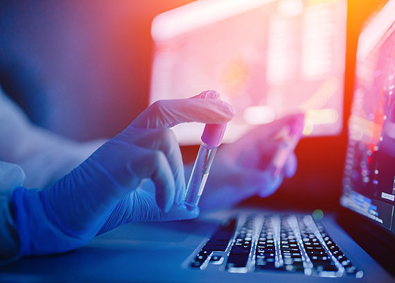 Zaka�enia wirusem SARS-CoV-2. Stan na godz: 10:00