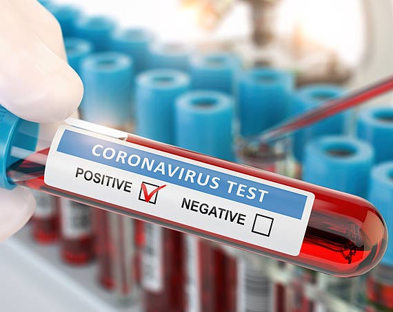 Zaka�enia wirusem SARS-CoV-2. Stan na godz: 10:00