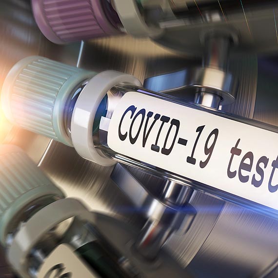 Zaka�enia wirusem SARS-CoV-2. Stan na godz: 10:00