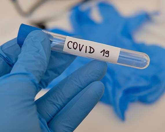 Zaka�enia wirusem SARS-CoV-2. Stan na godz: 10:00