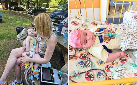 Ekstremalnie rzadki zesp Retta u chopca! Wojtu yje wbrew statystykom