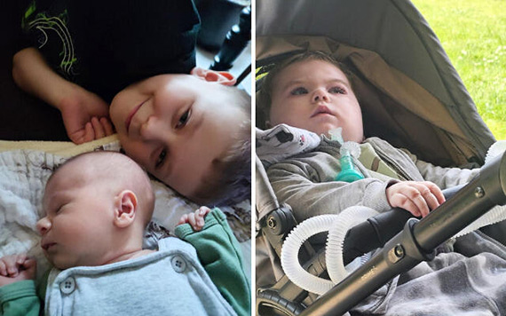 Ekstremalnie rzadki zesp Retta u chopca! Wojtu yje wbrew statystykom